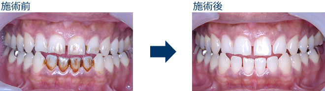 クリーニングのbefore after